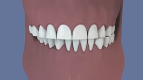 pathologies dentaires